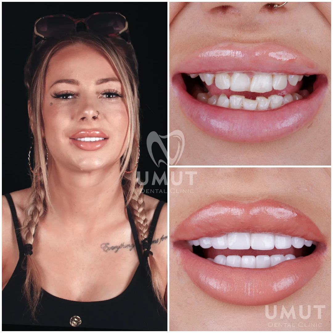 Etkinlik Fotoğrafı