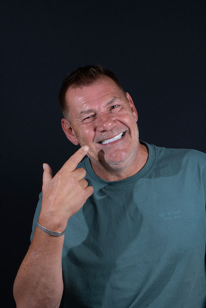 Laminate Veneers