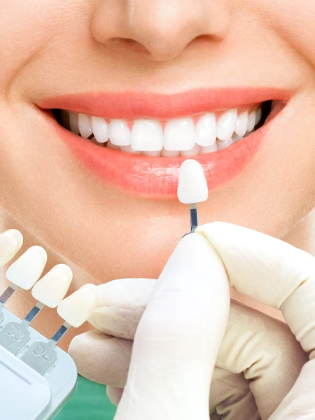 Pourquoi les contrôles oraux de routine sont-ils importants?