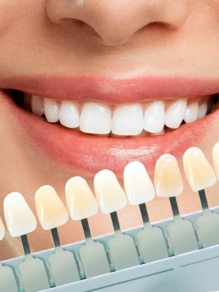 Ready to Transform Your Smile?