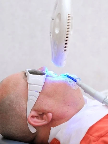 Avantages du Blanchiment des Dents au Laser: